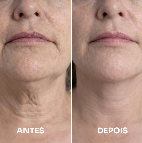 Mendicube - Sérum firmador e lifting para o pescoço com massageador integrado