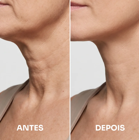 Mendicube - Sérum firmador e lifting para o pescoço com massageador integrado